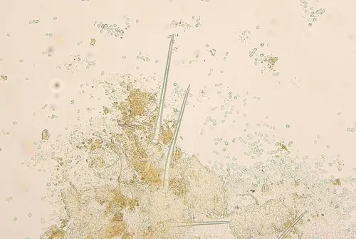 Trichobolus zukalii