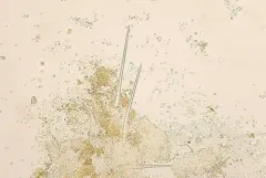 Trichobolus zukalii thumbnail 1