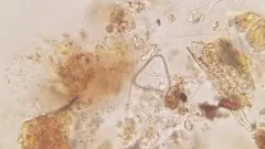 Staurastrum punctulatum thumbnail 2