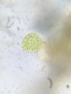 Pediastrum obtusum thumbnail 2