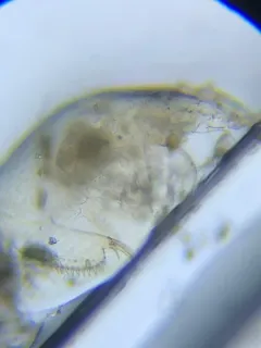Alona affinis thumbnail 3