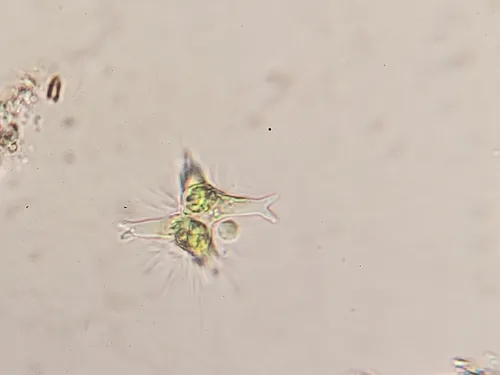 Staurastrum brachiatum