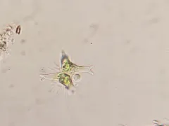 Staurastrum brachiatum thumbnail 1