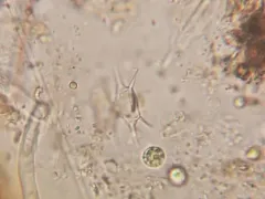 Staurodesmus octocornis thumbnail 2
