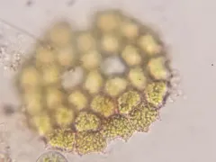 Pseudopediastrum integrum thumbnail 2