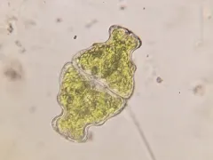 Euastrum ampullaceum thumbnail 1