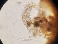 Dissotrocha aculeata thumbnail 1