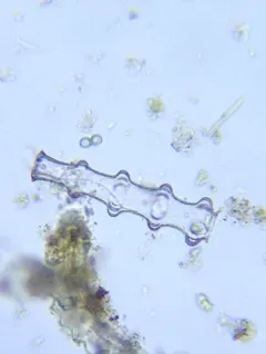 Pleurotaenium nodosum thumbnail 3