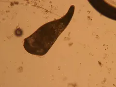 Stentor amethystinus thumbnail 2