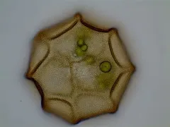 Arcella conica thumbnail 2