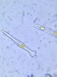 Gomphonema acuminatum thumbnail 2