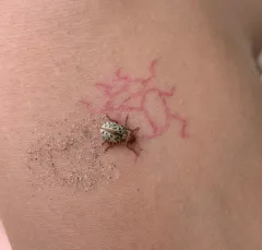 Calligrapha verrucosa thumbnail 2