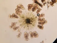 Conochilus hippocrepis thumbnail 4