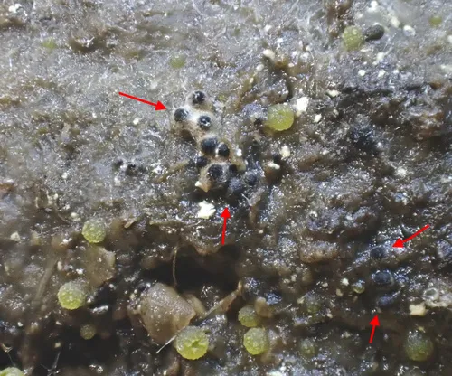 Sordaria humana