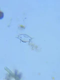 Xanthidium antilopaeum thumbnail 3