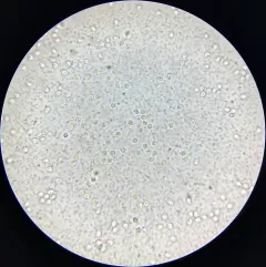 Tricholoma apium thumbnail 1