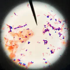 E. coli thumbnail 1