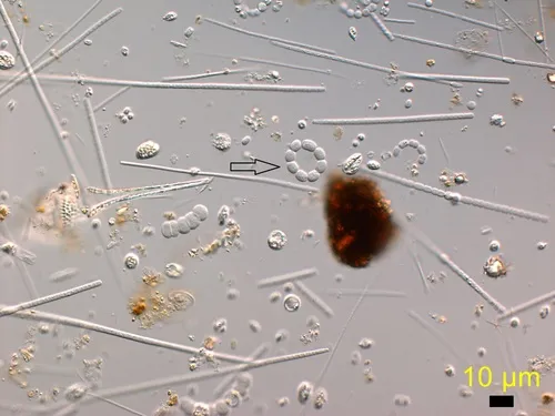 Anabaenopsis circularis