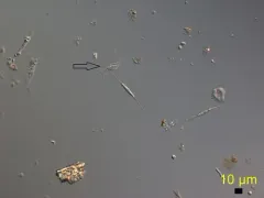 Dinobryon divergens thumbnail 2