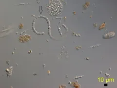 Dolichospermum flosaquae thumbnail 3