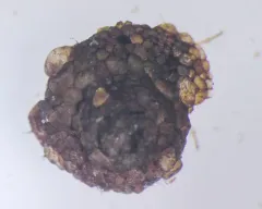 Spectacled Snail-case Caddisfly thumbnail 3