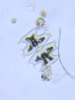 Micrasterias depauperata thumbnail 2