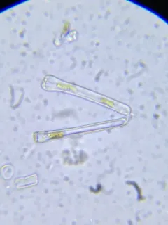 Actinella punctata thumbnail 1