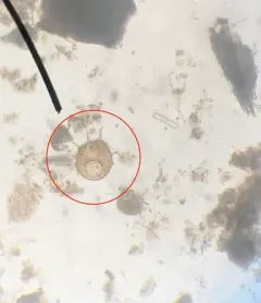 Centropyxis aculeata thumbnail 1