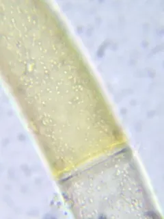 Closterium baillyanum thumbnail 2