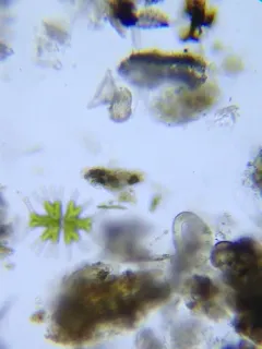 Micrasterias furcata thumbnail 3