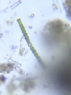 Docidium undulatum thumbnail 2