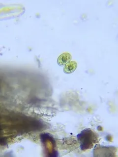 Cosmarium contractum thumbnail 4