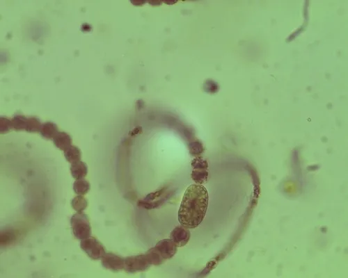 Dolichospermum spiroides