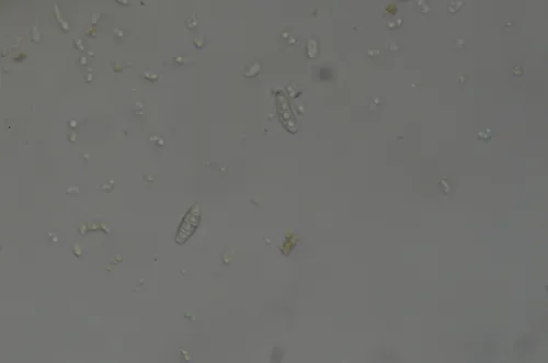 Phlebia nothofagi