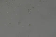 Phlebia nothofagi thumbnail 1