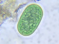 Cyanothece aeruginosa thumbnail 3