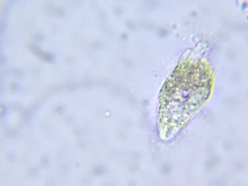 Phialina pupula