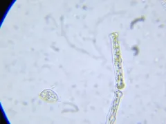 Tabellaria fenestrata thumbnail 3