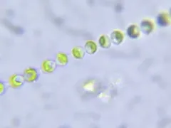 Radiofilum conjunctivum thumbnail 2