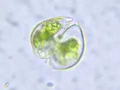 Staurodesmus dickiei thumbnail 2