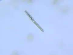 Haplotaenium minutum thumbnail 2