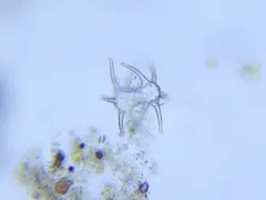 Staurastrum ophiura thumbnail 2