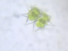 Staurastrum furcigerum thumbnail 3