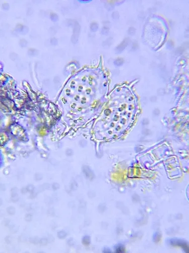 Xanthidium tetracentrotum
