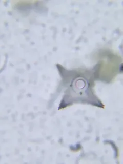 Staurastrum cerastes thumbnail 3