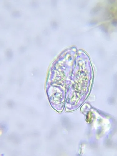 Cosmarium pseudotaxichondrum
