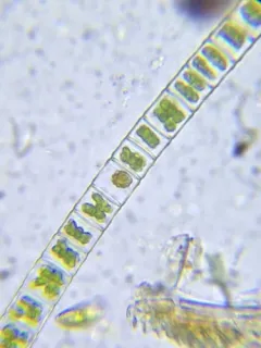 Hyalotheca mucosa thumbnail 4