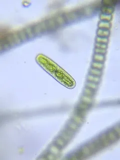 Netrium oblongum thumbnail 1