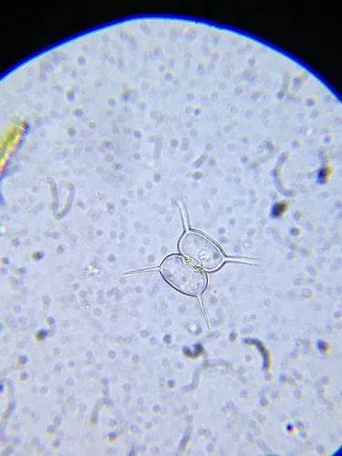 Staurodesmus bulnheimii