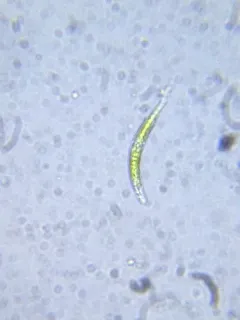 Euglena mutabilis thumbnail 2